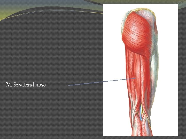 M. Semitendinoso 