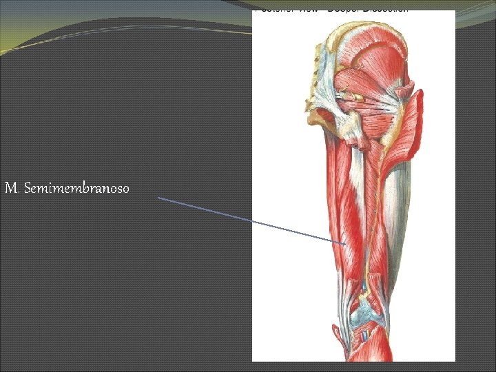 M. Semimembranoso 