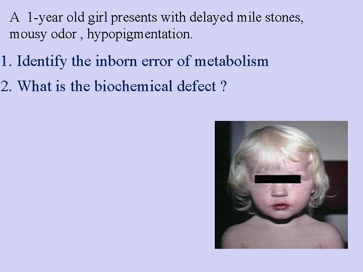 A 1 -year old girl presents with delayed mile stones, mousy odor , hypopigmentation.