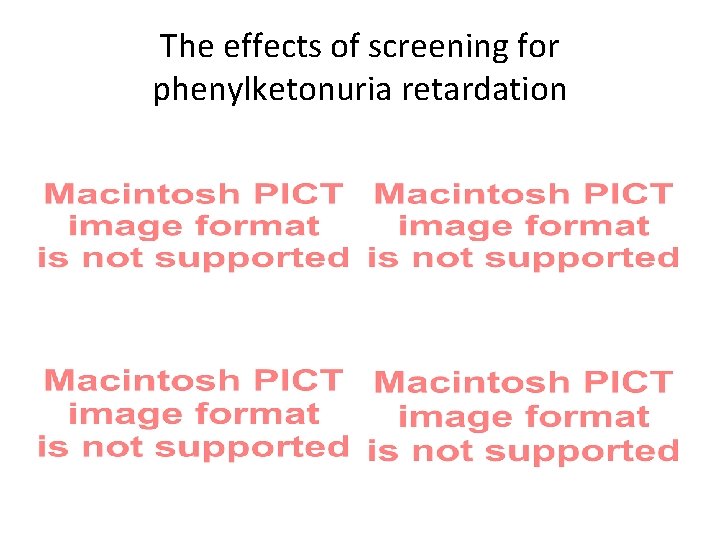 The effects of screening for phenylketonuria retardation 