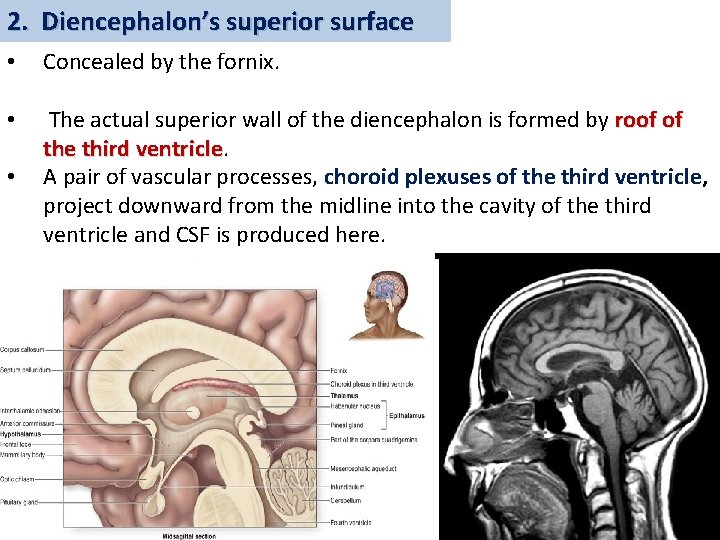 2. Diencephalon’s superior surface • Concealed by the fornix. • The actual superior wall