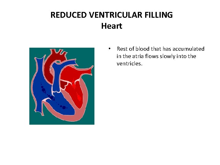 REDUCED VENTRICULAR FILLING Heart • Rest of blood that has accumulated in the atria