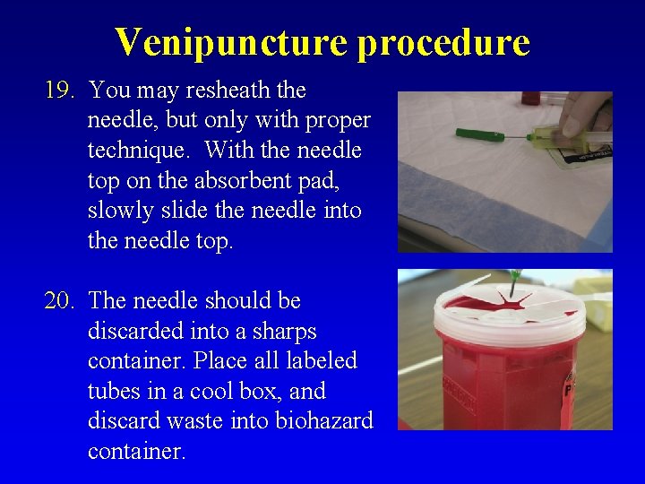 Venipuncture procedure 19. You may resheath the needle, but only with proper technique. With
