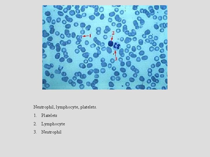 Neutrophil, lymphocyte, platelets. 1. Platelets 2. Lymphocyte 3. Neutrophil 