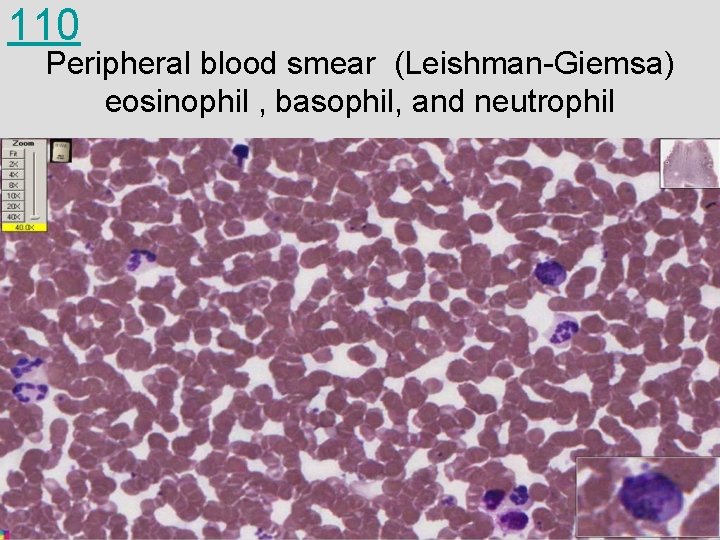 110 Peripheral blood smear (Leishman-Giemsa) eosinophil , basophil, and neutrophil 