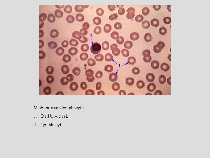 Medium-sized lymphocyte 1. Red blood cell 2. lymphocyte 