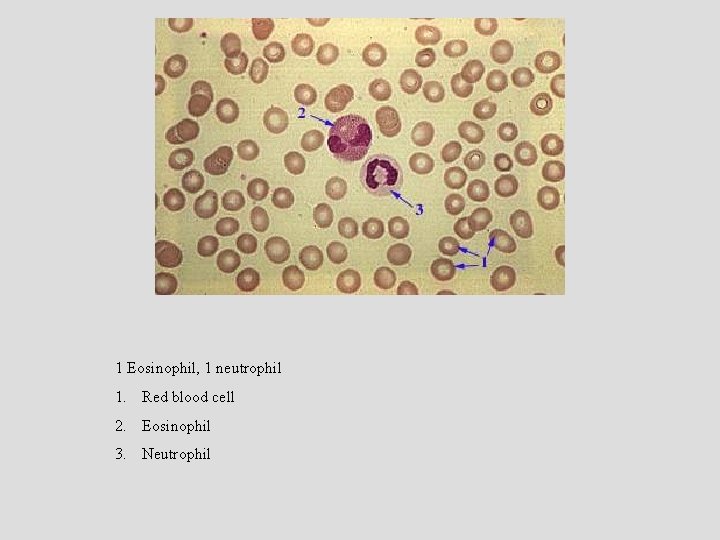 1 Eosinophil, 1 neutrophil 1. Red blood cell 2. Eosinophil 3. Neutrophil 