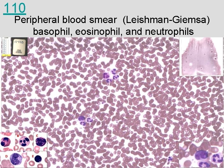 110 Peripheral blood smear (Leishman-Giemsa) basophil, eosinophil, and neutrophils 