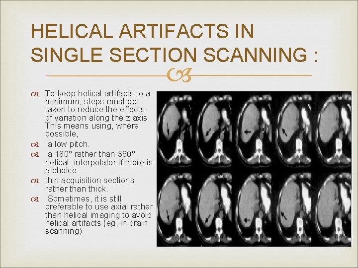 HELICAL ARTIFACTS IN SINGLE SECTION SCANNING : To keep helical artifacts to a minimum,