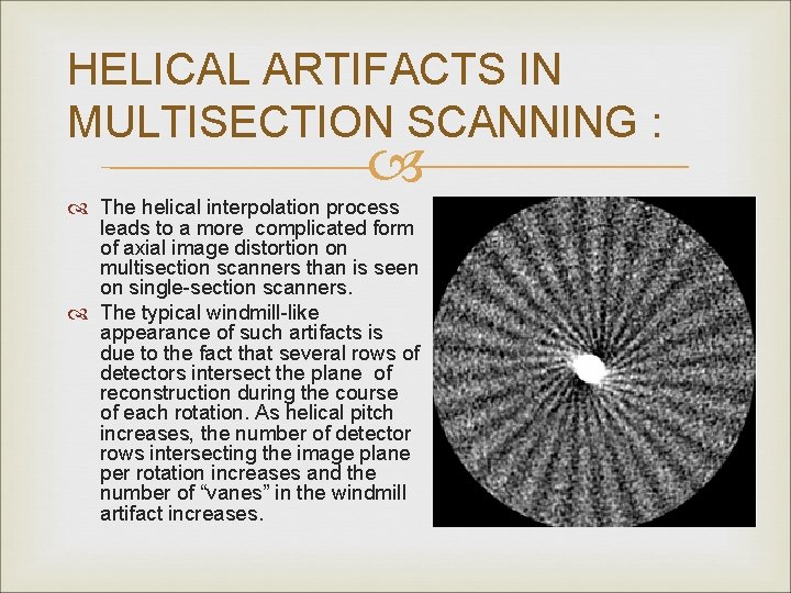 HELICAL ARTIFACTS IN MULTISECTION SCANNING : The helical interpolation process leads to a more