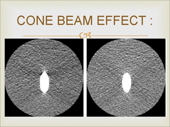 CONE BEAM EFFECT : 