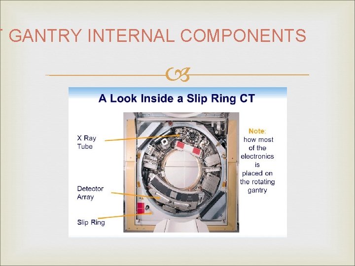 T GANTRY INTERNAL COMPONENTS 