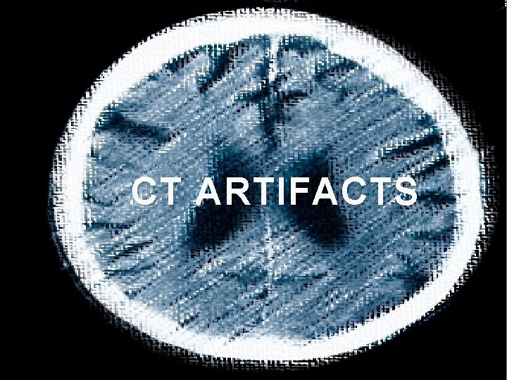  CT ARTIFACTS 