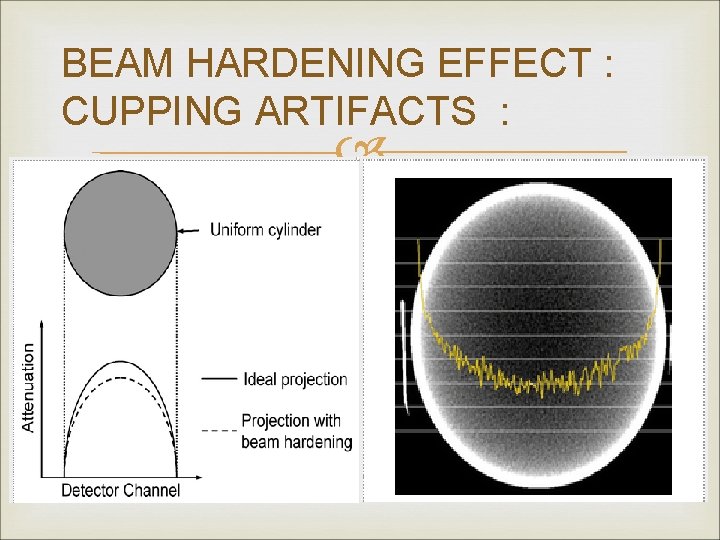 BEAM HARDENING EFFECT : CUPPING ARTIFACTS : 