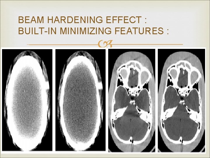 BEAM HARDENING EFFECT : BUILT-IN MINIMIZING FEATURES : 