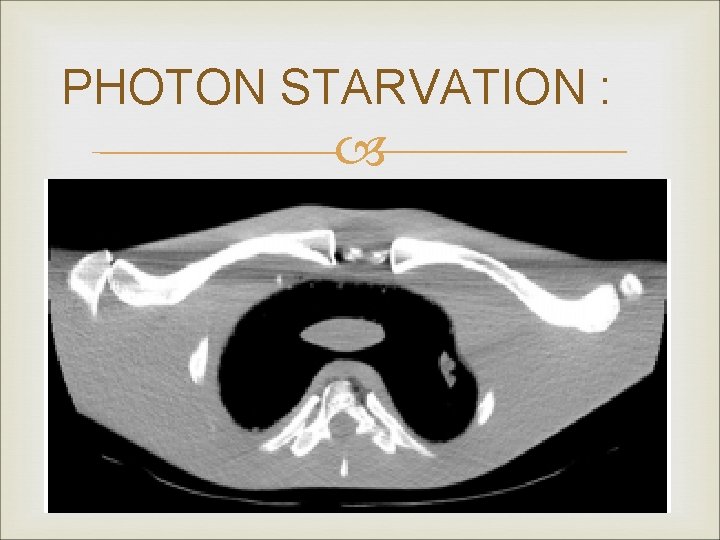 PHOTON STARVATION : 