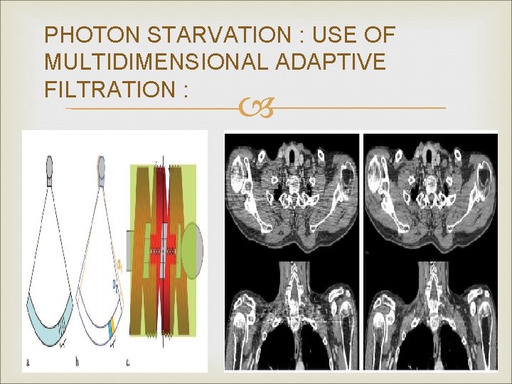 PHOTON STARVATION : USE OF MULTIDIMENSIONAL ADAPTIVE FILTRATION : 