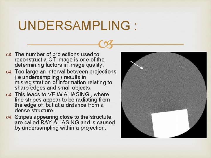 UNDERSAMPLING : The number of projections used to reconstruct a CT image is one