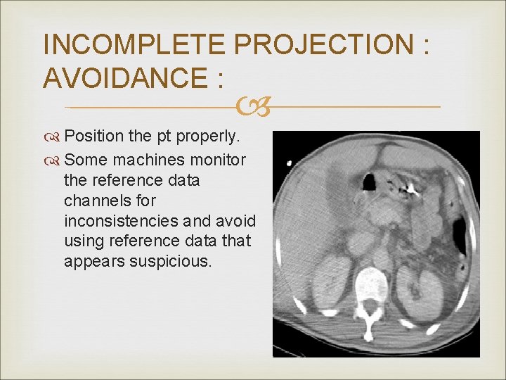 INCOMPLETE PROJECTION : AVOIDANCE : Position the pt properly. Some machines monitor the reference