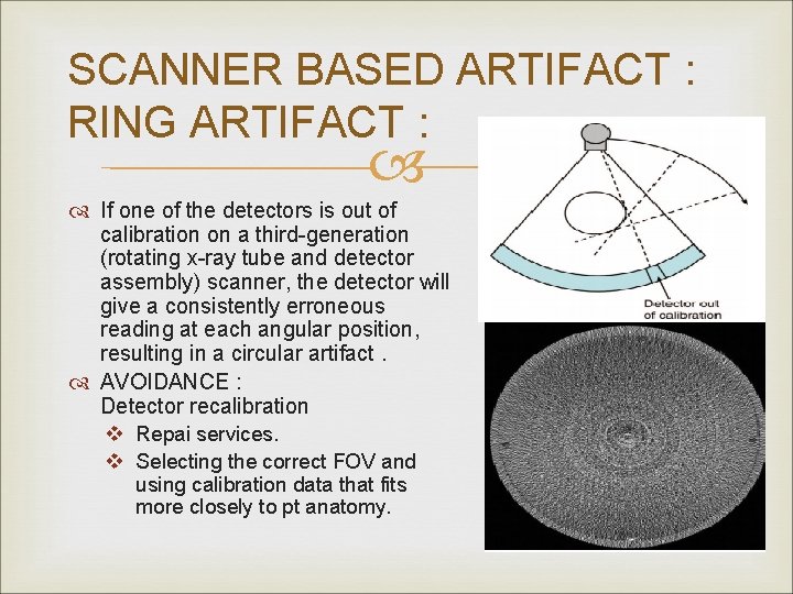 SCANNER BASED ARTIFACT : RING ARTIFACT : If one of the detectors is out