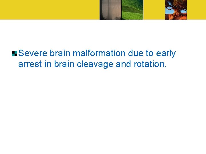 Severe brain malformation due to early arrest in brain cleavage and rotation. 