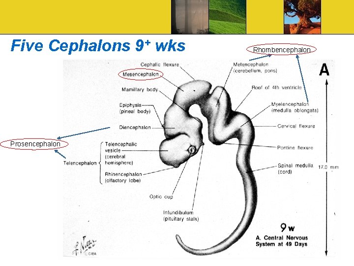 Five Cephalons 9+ wks Prosencephalon Rhombencephalon 