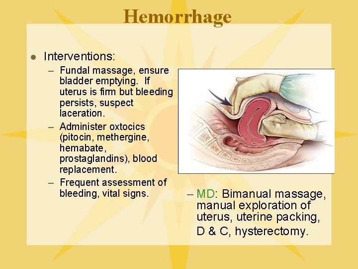 Hemorrhage l Interventions: – Fundal massage, ensure bladder emptying. If uterus is firm but