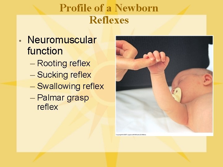 Profile of a Newborn Reflexes • Neuromuscular function – Rooting reflex – Sucking reflex