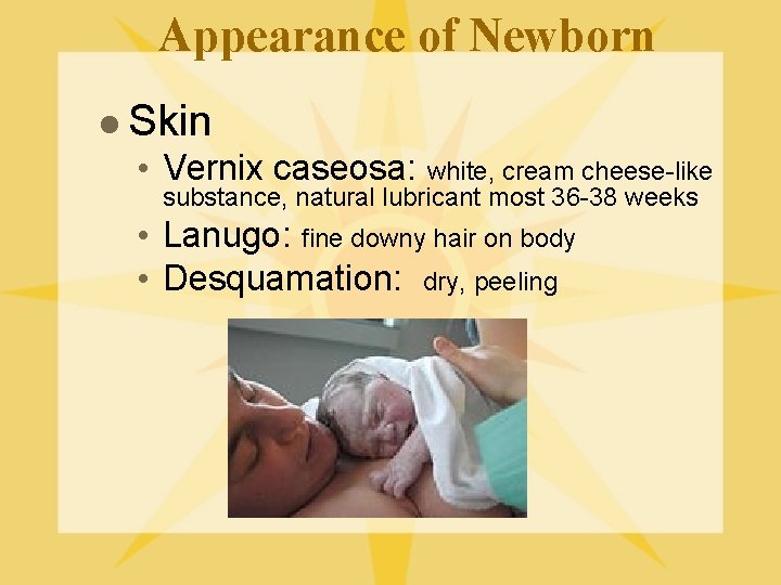 Appearance of Newborn l Skin • Vernix caseosa: white, cream cheese-like substance, natural lubricant
