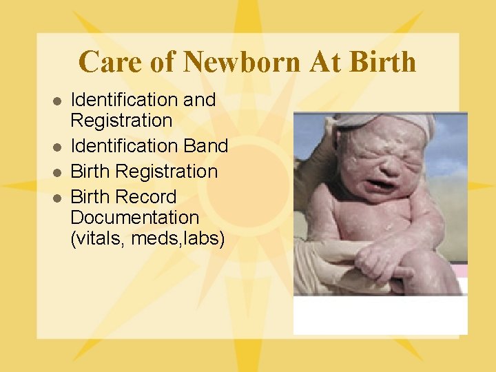 Care of Newborn At Birth l l Identification and Registration Identification Band Birth Registration