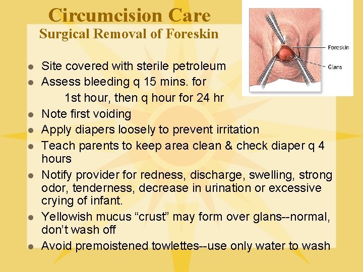 Circumcision Care Surgical Removal of Foreskin l l l l Site covered with sterile