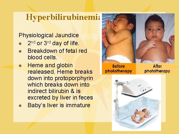 Hyperbilirubinemia Physiological Jaundice l 2 nd or 3 rd day of life. l Breakdown