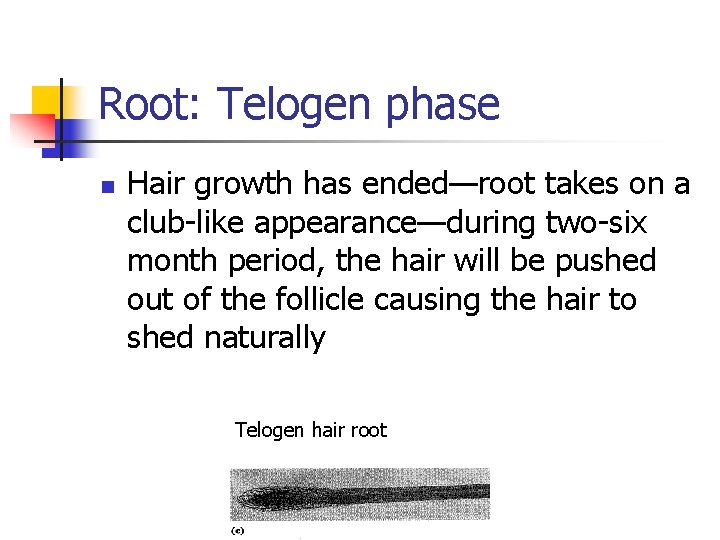 Root: Telogen phase n Hair growth has ended—root takes on a club-like appearance—during two-six