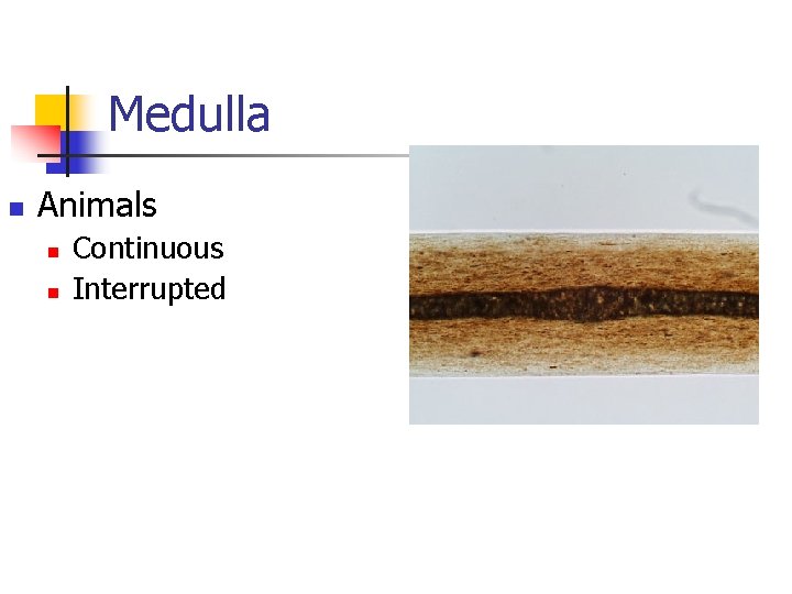 Medulla n Animals n n Continuous Interrupted 