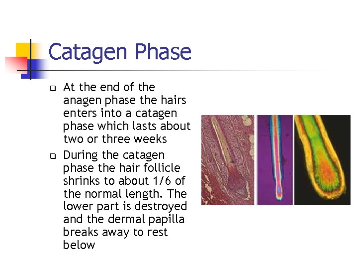 Catagen Phase q q At the end of the anagen phase the hairs enters