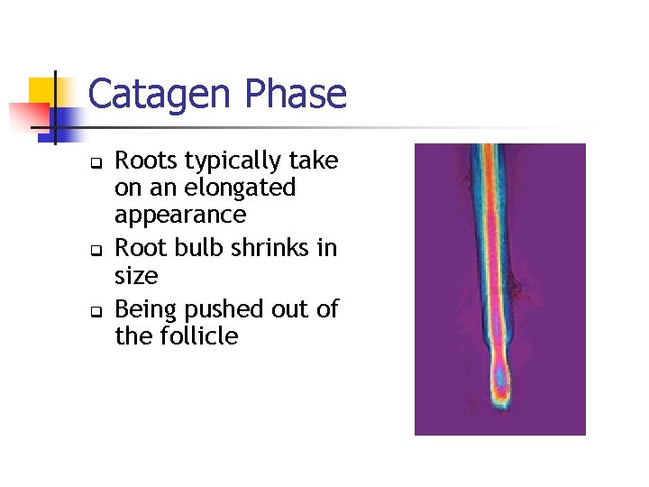 Catagen Phase q q q Roots typically take on an elongated appearance Root bulb