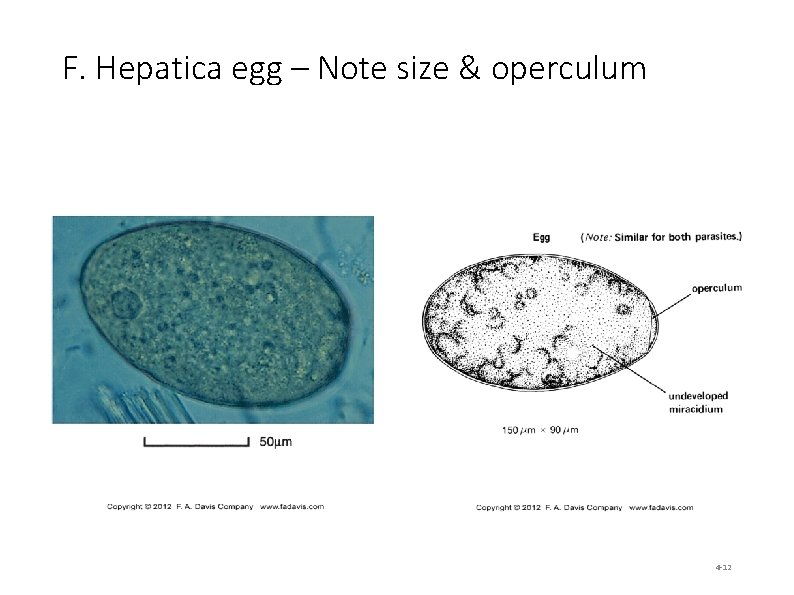 F. Hepatica egg – Note size & operculum 4 -12 