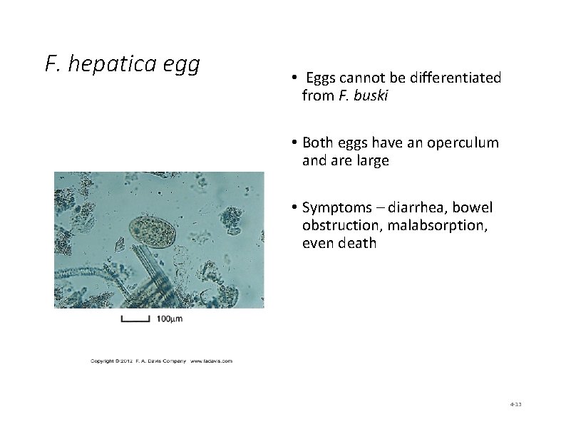 F. hepatica egg • Eggs cannot be differentiated from F. buski • Both eggs