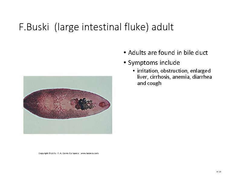 F. Buski (large intestinal fluke) adult • Adults are found in bile duct •