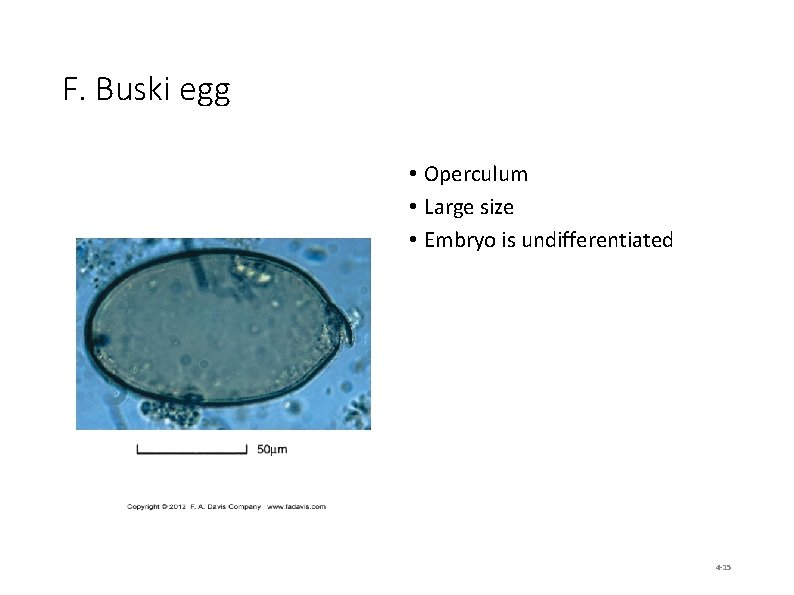 F. Buski egg • Operculum • Large size • Embryo is undifferentiated 4 -15