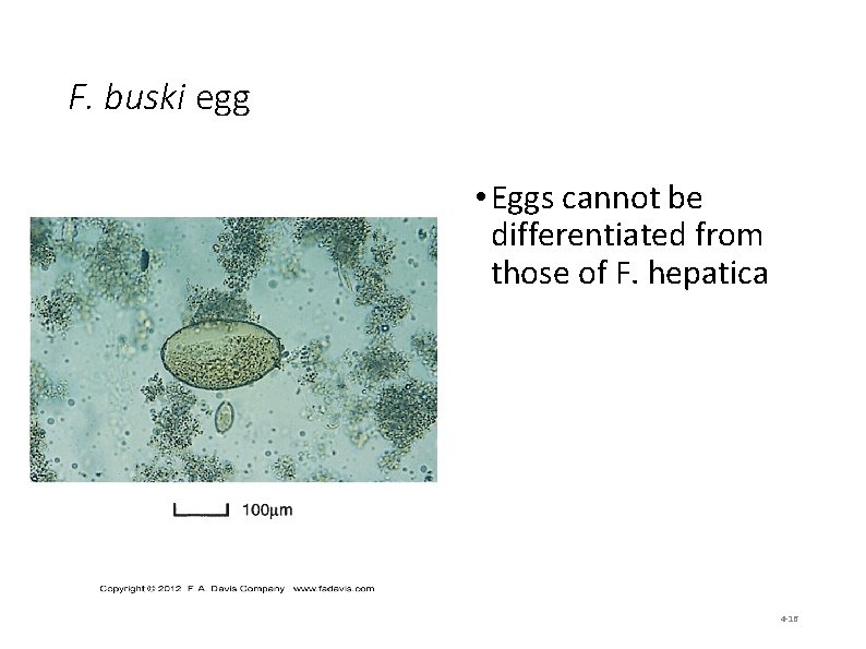 F. buski egg • Eggs cannot be differentiated from those of F. hepatica 4