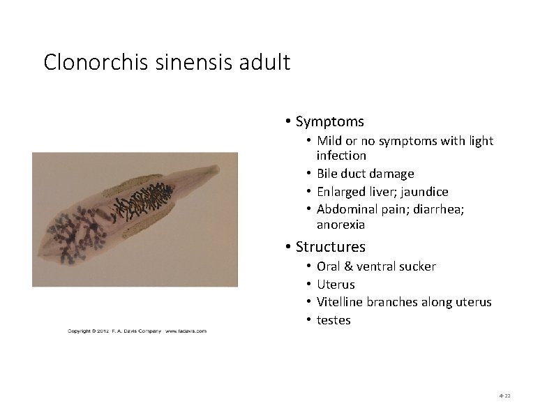 Clonorchis sinensis adult • Symptoms • Mild or no symptoms with light infection •