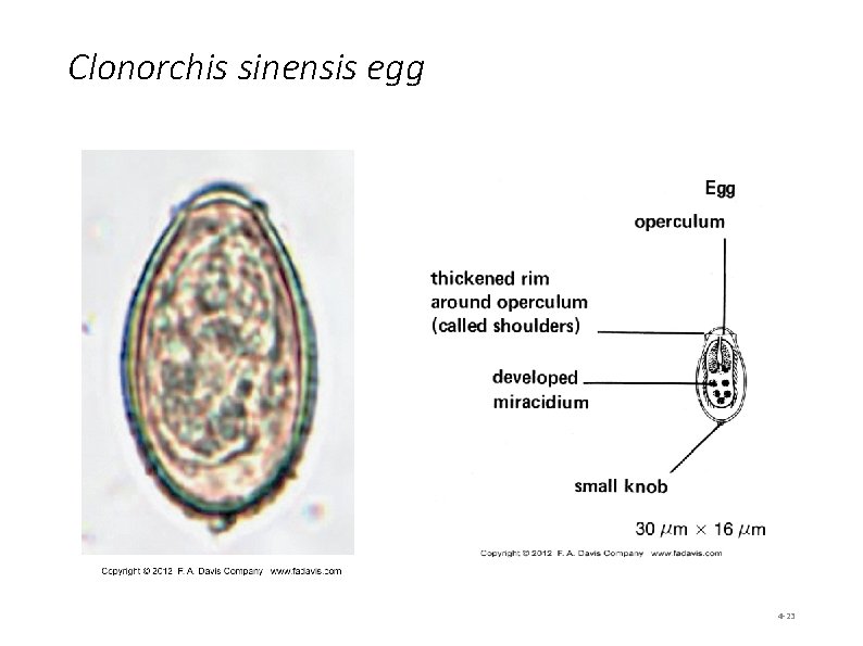 Clonorchis sinensis egg 4 -23 