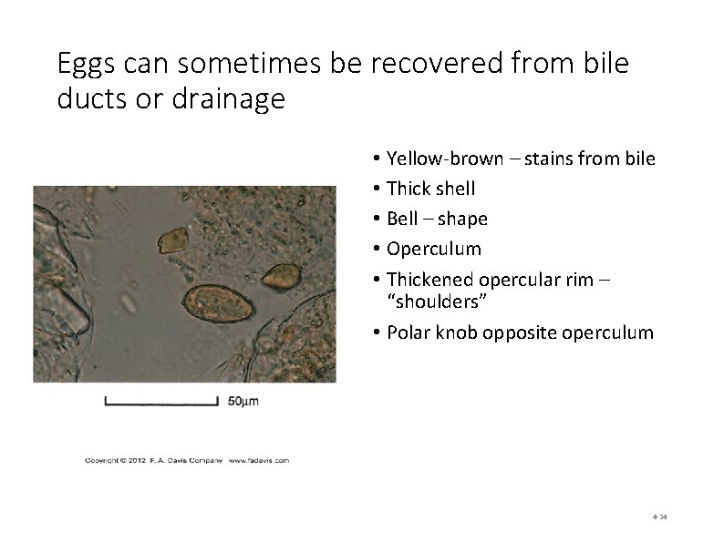 Eggs can sometimes be recovered from bile ducts or drainage • Yellow-brown – stains