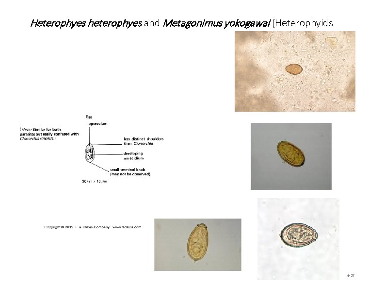 Heterophyes heterophyes and Metagonimus yokogawai (Heterophyids 4 -27 
