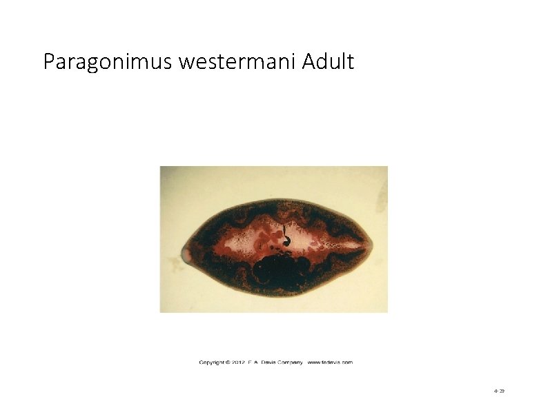 Paragonimus westermani Adult 4 -29 