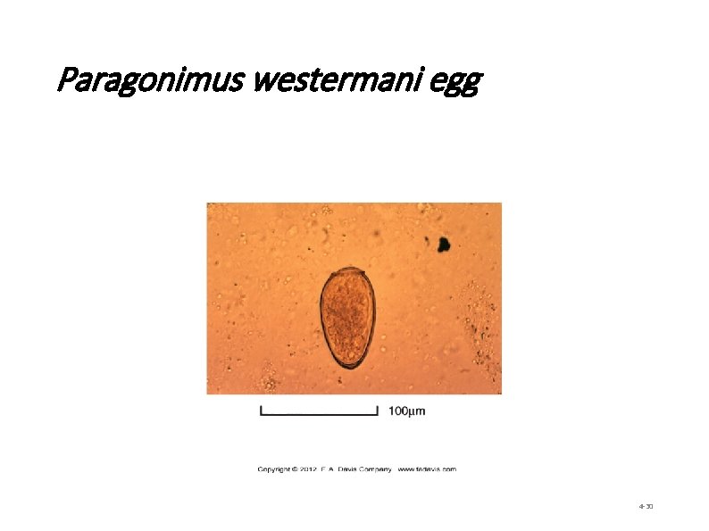 Paragonimus westermani egg 4 -30 