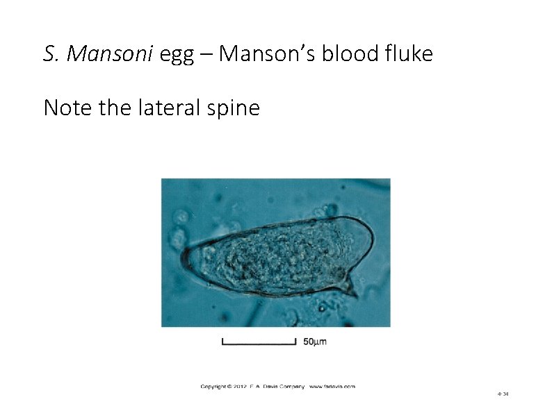 S. Mansoni egg – Manson’s blood fluke Note the lateral spine 4 -34 