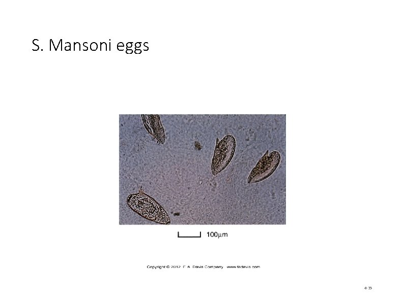 S. Mansoni eggs 4 -35 