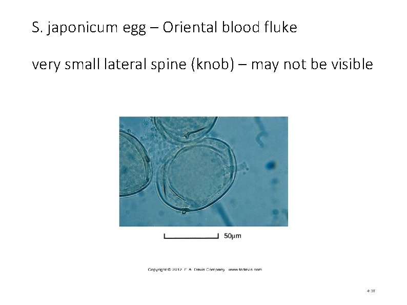 S. japonicum egg – Oriental blood fluke very small lateral spine (knob) – may